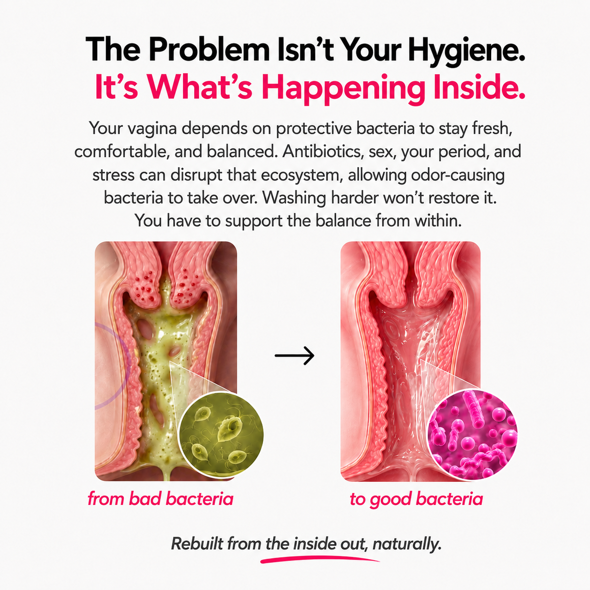 FLORA+ Vaginal Probiotic By FEM8